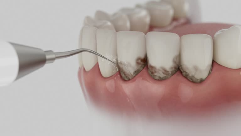 Reliable Dental Implants contractor in Stevenson, WA by Smile Center Dentistry